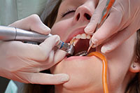 歯ぐきの腫れ・出血 膿が出る・歯肉の痛み等