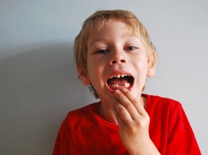 子供の歯並び